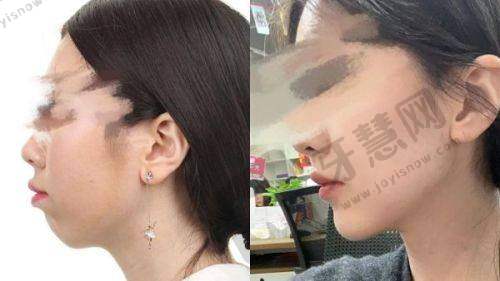 探秘洛阳莱尔美整形：刘战辉院长实力几何？项目价格全揭秘！