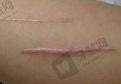 郑州华领医疗美容——综合性正规美容的优质之选