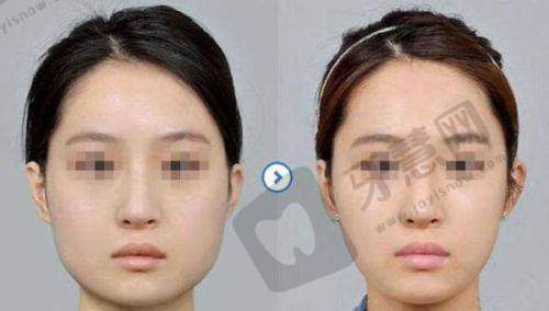 郑州美莱整形美容医院——值得信赖的人性化整形机构