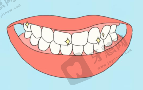 齐齐哈尔鹤翔口腔门诊部一般的牙套需要多少钱——陶瓷牙套价格详情