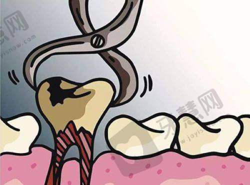 厦门博德口腔门诊部一颗牙冠大概多少钱一颗——牙冠修复后的注意事项