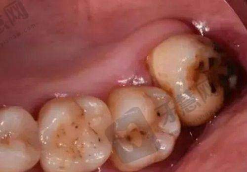 泰康拜博口腔医院评价