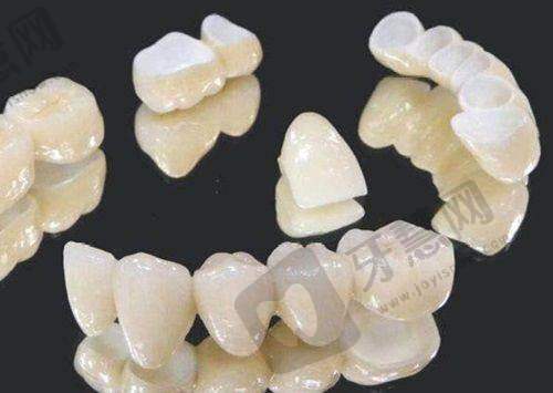 湛江南方口腔医院一般的牙套需要多少钱？6000 起享个性化定制及专业售后