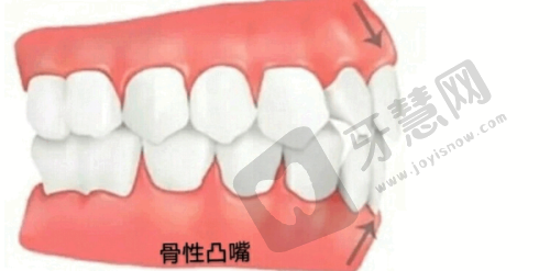 无锡佳士洁口腔(清扬店)做烤瓷牙套多少钱一颗牙——相关医生介绍