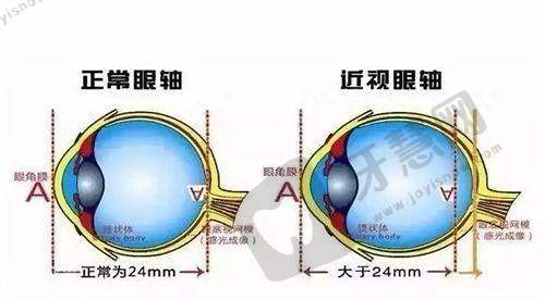 北京爱尔英智眼科彭晓燕信息、收费及预约挂号全解析