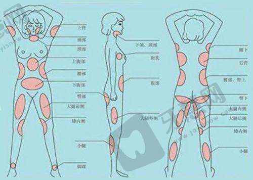 王旭明医生鼻子手术评价