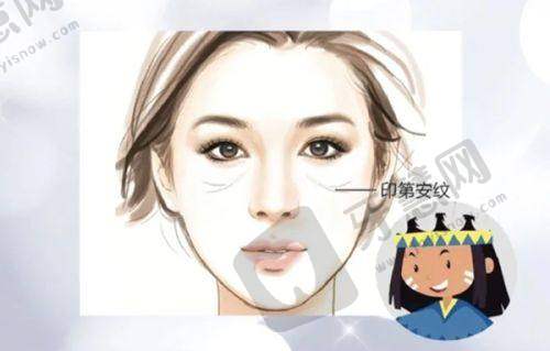 总结推荐贺焕焕医生做拉皮提升