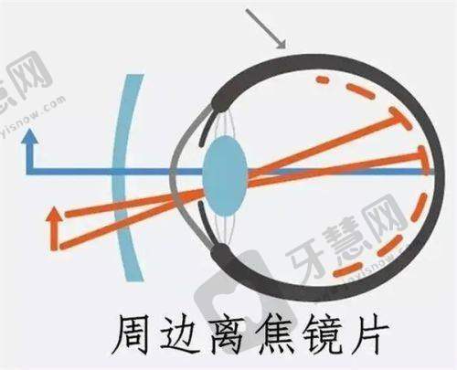 北京阿玛施眼科门诊部：专业近视矫正，技术优服务好价格合理