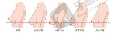 西安国际医学中心医院整形医院顾客体验好不好：医院口碑反馈