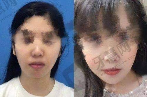 杭州浮想国医疗美容门诊部口碑反馈