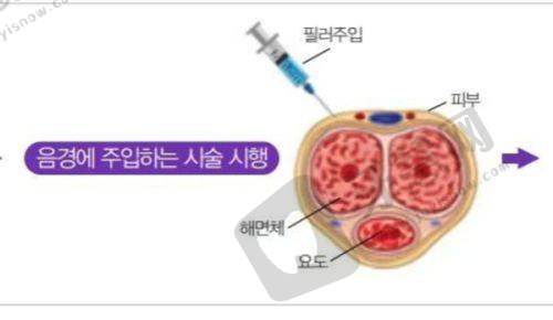 西安高一生医疗美容医院官网查看眼部整形项目医生水平:医院地址与挂号指南
