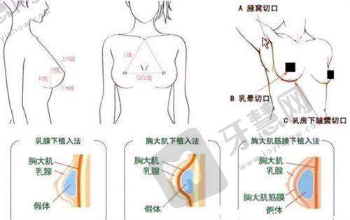 总结评价：沈阳华美疤痕医院祛疤强者，值得信赖