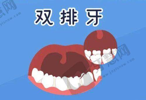 重庆理想口腔医院肖胤医生的就诊指南