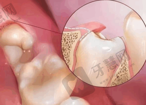 重庆美奥口腔医院张书恒医生怎么样？擅长正畸种植，价格合理，周一至周五坐诊