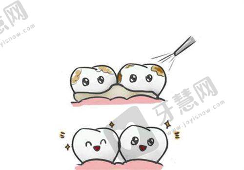 重庆美奥口腔医院刘靖医生怎么样？擅长半口种植技术，坐诊渝北店价格合理