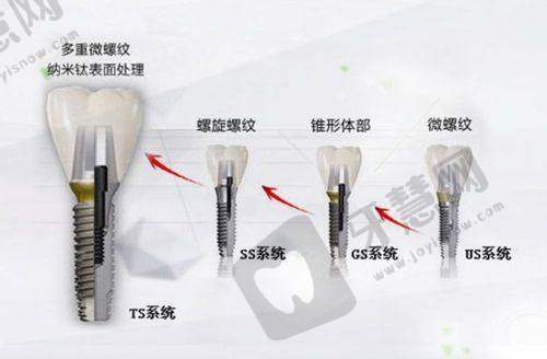 重庆美奥张书恒医生的患者心声