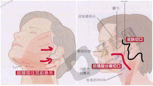 西安国际医学中心医院整形医院顾客体验好不好:医院价格参考