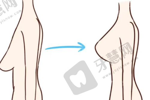 西安高一生医疗美容医院官网查看眼部整形项目医生水平:医院价格参考