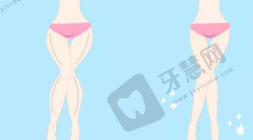 深圳富华医疗整形医院双眼皮整形项目效果怎么样？医生技术好恢复快，16800元口碑佳