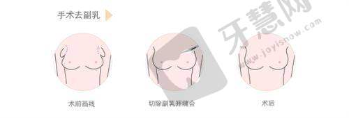 西安壹加壹医疗美容医院：便捷效率高的激光脱毛服务