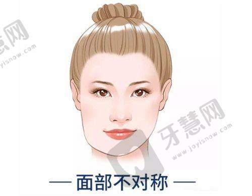 中山市人民医院光子嫩肤价格分析