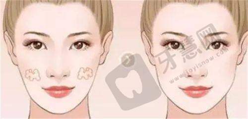 深圳富华医疗整形医院双眼皮整形项目:医院价格参考