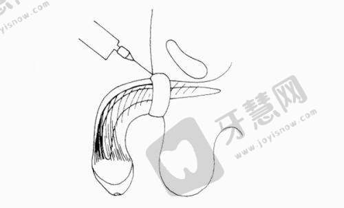 长沙美莱医美医院全揭秘：项目、医生、价格及周边配套大曝光