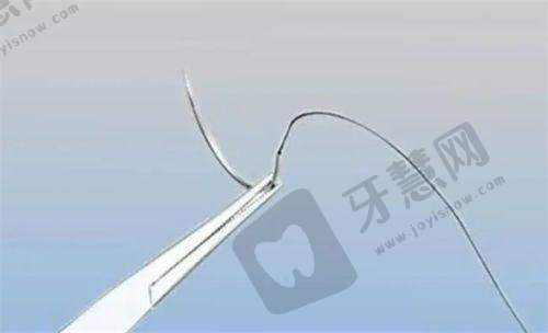 碧莲盛植发总结
