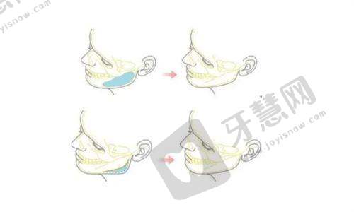 深圳富华医疗整形医院双眼皮整形项目:医院口碑反馈