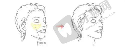 结尾