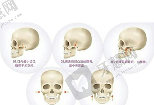 西安高一生医疗美容医院官网查看眼部整形项目医生水平：医院特色亮点