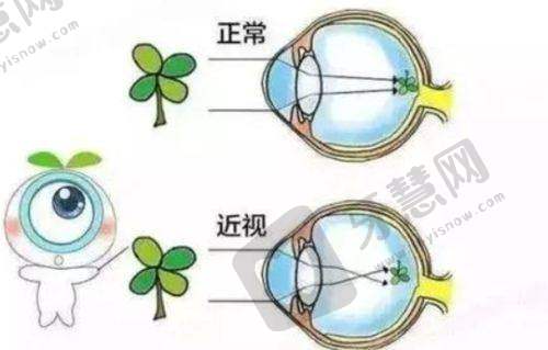 真实评价见证重庆爱尔眼科口碑