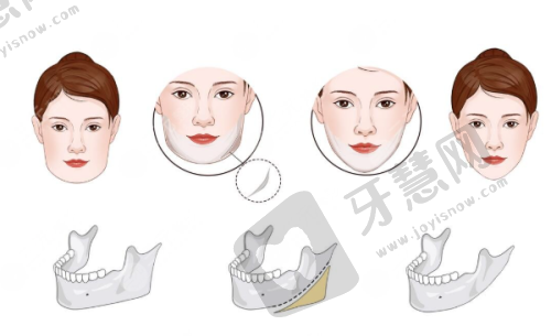 南通整形医院排名榜前十之南通佳美医疗美容门诊部