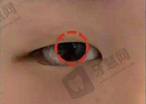 南通牙齿矫正哪家医院好——南通美奥口腔