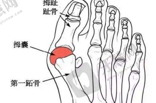 二、广州富贵包治疗正规医院技术对比