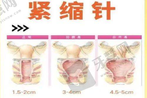 南通整形医院排名榜前十之南通维多利亚医疗美容医院