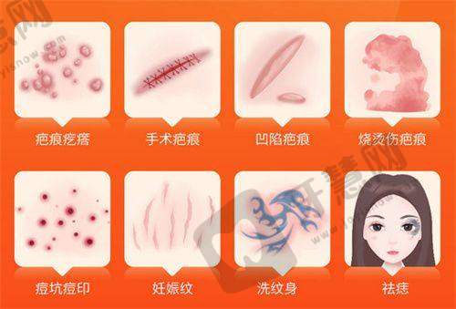 南通拉皮除皱哪家医院好——南通大学附属医院整形美容科