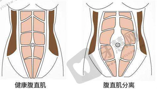 南通隆鼻医院排名榜之医院选择建议