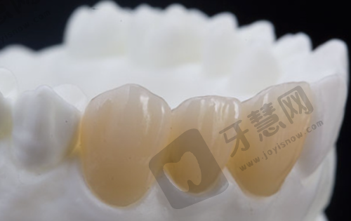 肇庆牙科一般去哪里比较好——肇庆市综合牙科诊所价格与技术分析