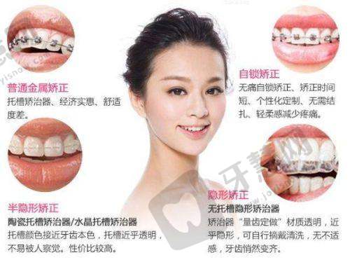 南京儿童口腔医院排名之固德口腔医院
