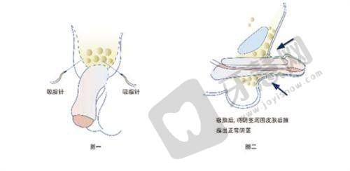 康美整形医院正规口碑好之收费透明合理