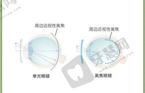 深圳市龙岗区平湖人民医院眼科口碑好不好?附真实患者口碑评价