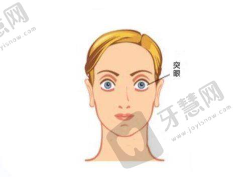 深圳市宝安区福永人民医院眼科项目特色