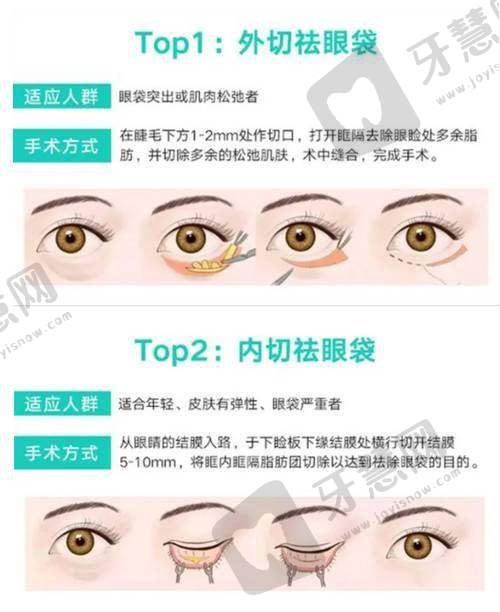 郑州爱美眼医疗美容诊所特色项目及技术优势