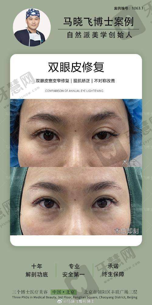 上海瑰丽美容门诊部详细的预约挂号方式及流程