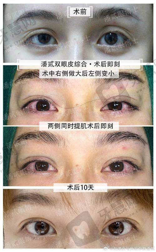 上海蔷薇阳光医疗美容门诊部特色项目及技术优势