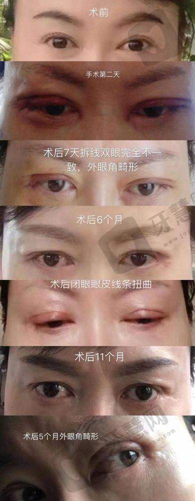 大连雅婷医疗美容门诊部是正规医院吗?
