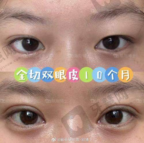 张金娥医生的顾客好评反馈