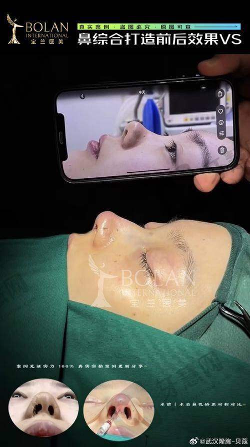 上海鹏爱医疗美容医院是正规医院吗?