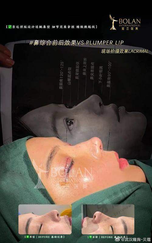 郑州爱美眼医疗美容诊所医生团队实力强大及骨干医生简介